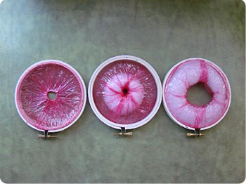 Dialation of cervix in labor.